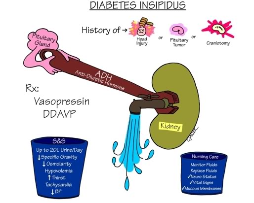 Central-Diabetes-Insipidus