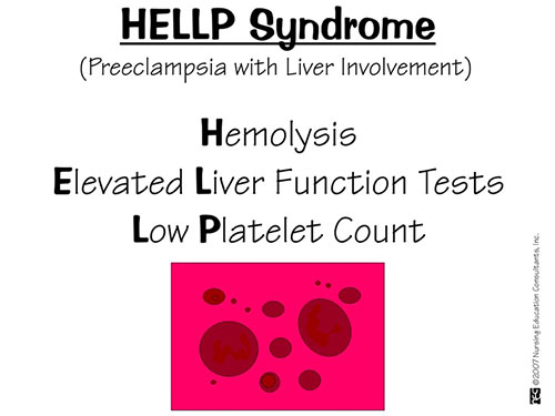 hellp syndrome
