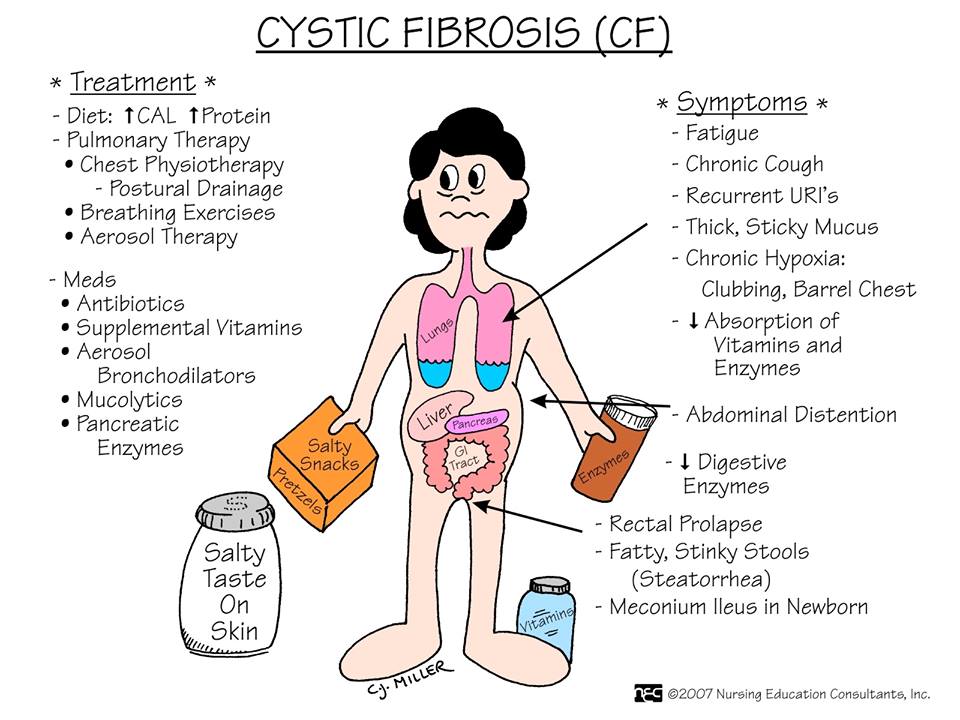 Cystic Fibrosis Cf The Nursing Station